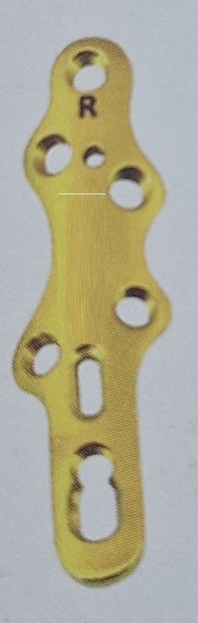 TM Bauer’s Synthes Пластина для артродезу 1-го плеснофалангового суглоба, права